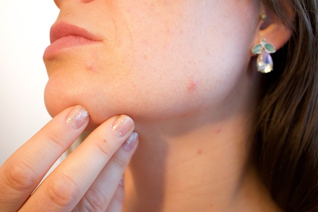 6 Common Skin Conditions And How to Treat Them Naturally